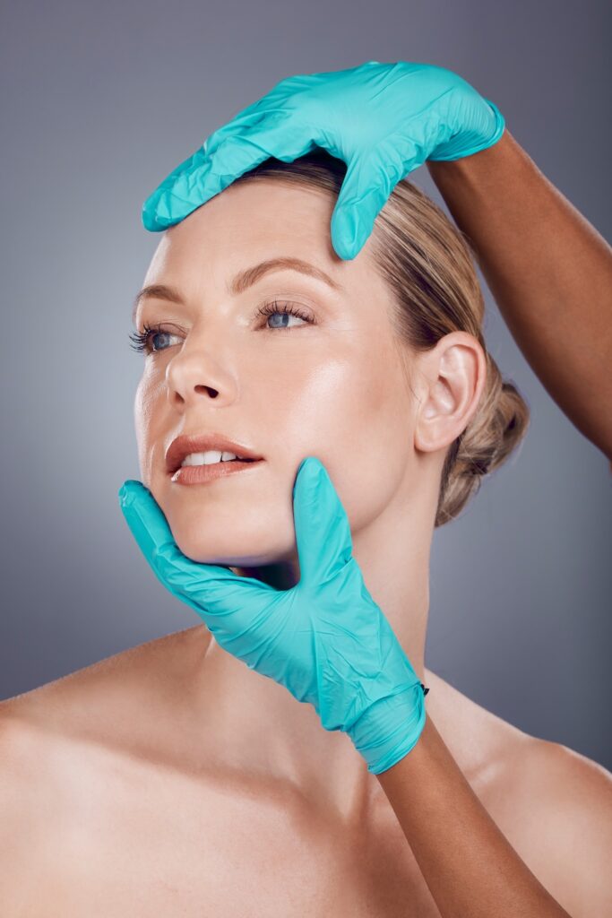 Facelift patient showing improved jawline definition and facial contour