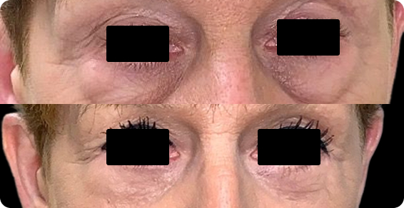 Before image