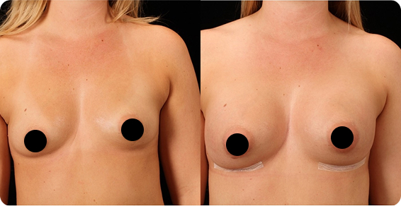 Before image