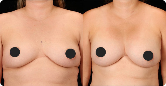 Before image