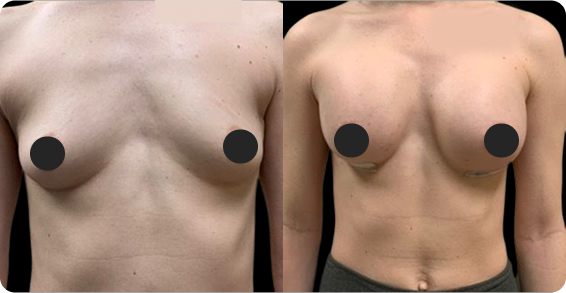 Before image