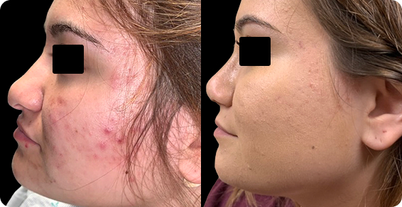 After image